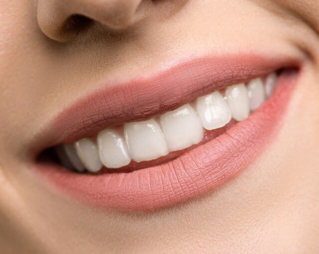 Oral Health